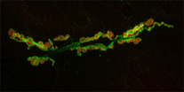 neuromuscular junctions under a microscope
