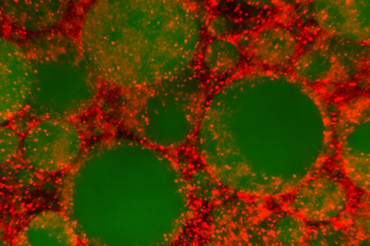 Lipid droplets (in green) and the ALS8-associated protein DVAP (in red) in the fat body (adipose tissue) of the fruit-fly. 
