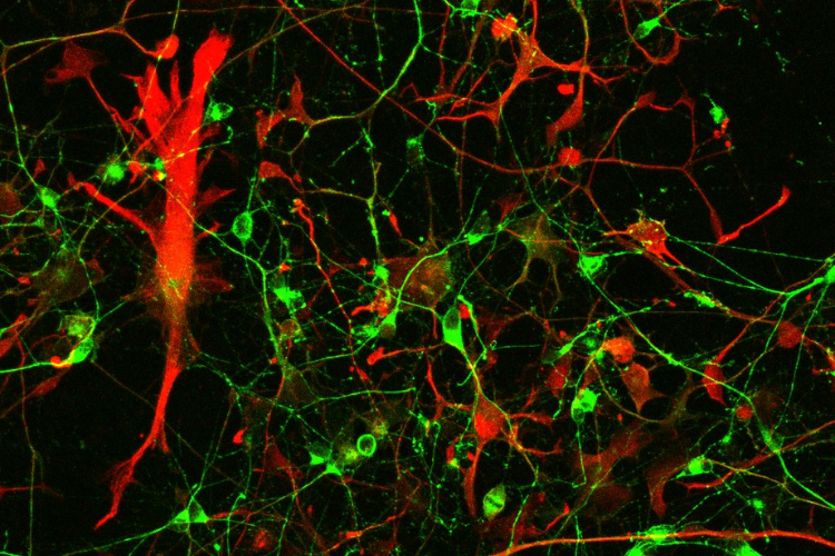  Co-culture of human stem cell derived astrocytes (red) and motor neurons (green)